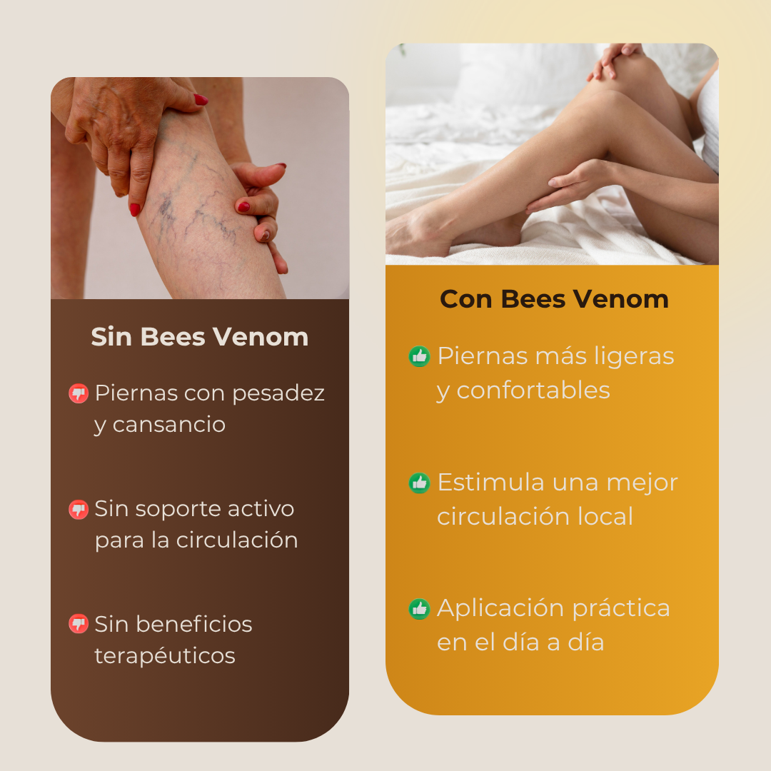 Spray para Várices Bees Venom - RECUPERA LA SALUD DE TUS PIERNAS 😍Lleva 2 y Paga 1 😍