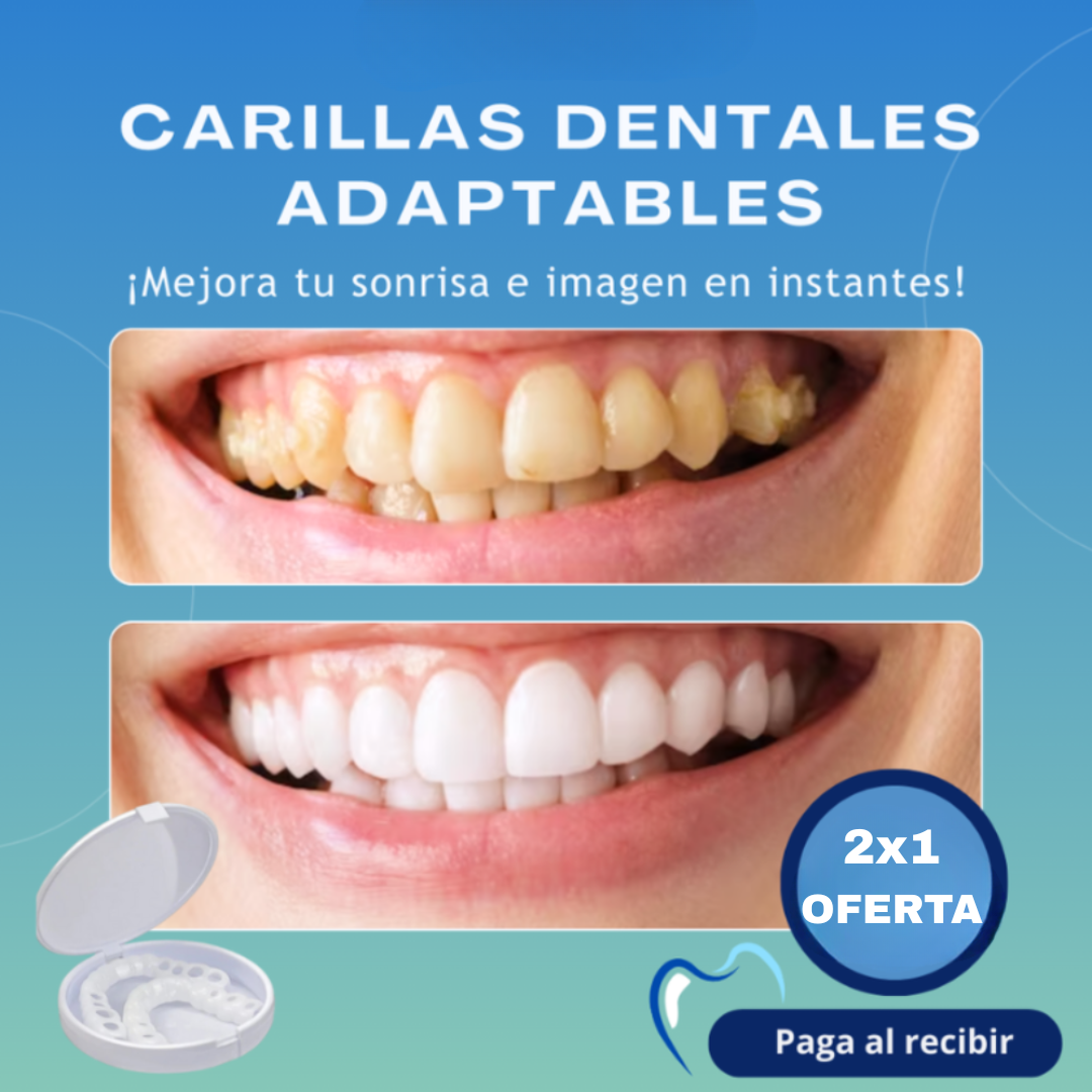 Carillas Dentales Adaptables - Transforma tu Sonrisa 😱OFERTA EXCLUSIVA 2X1😱
